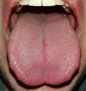 Why you should brush your tongue